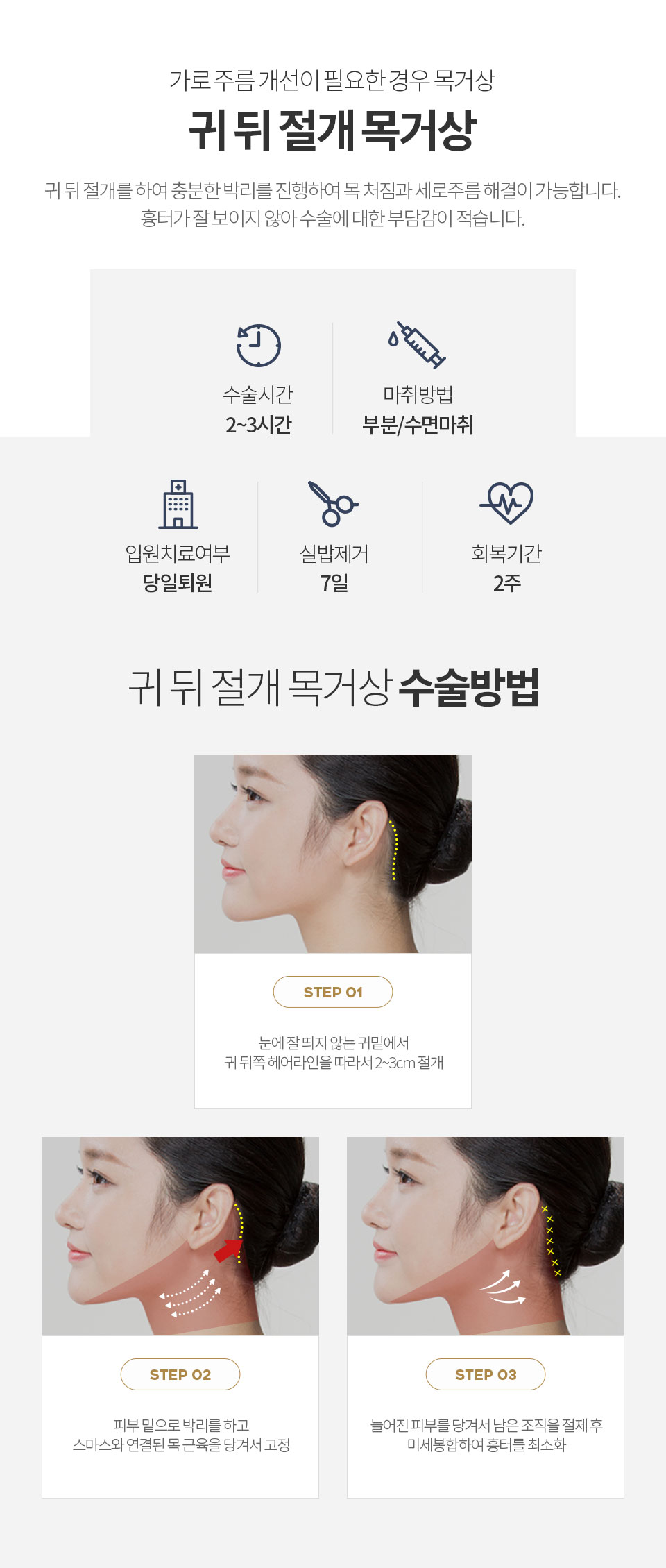 �� �� ���� ��Ż�