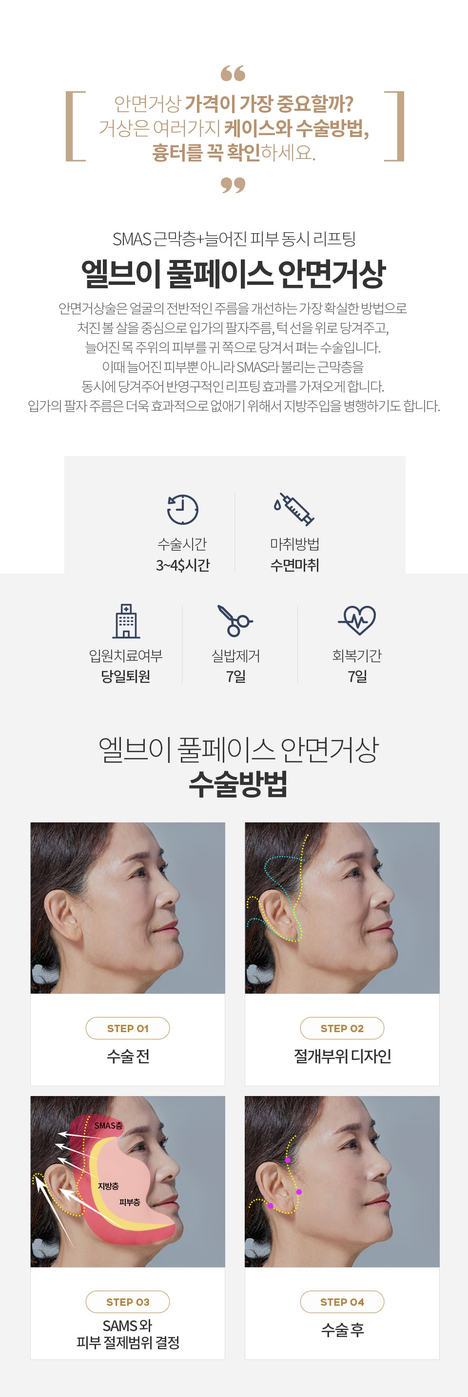 �󱼰Ż�, ���ָ����ż�����