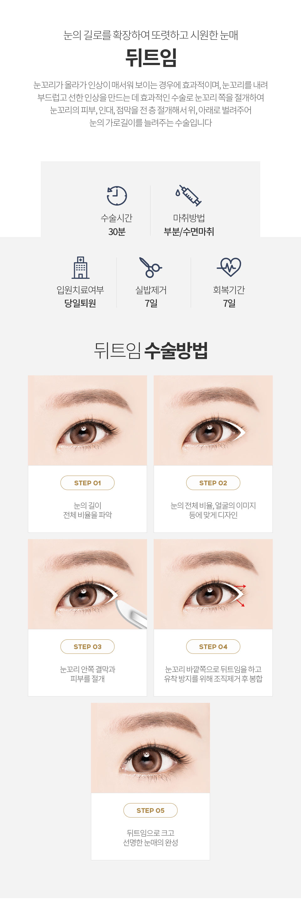 자연유착 최소절개 매몰법