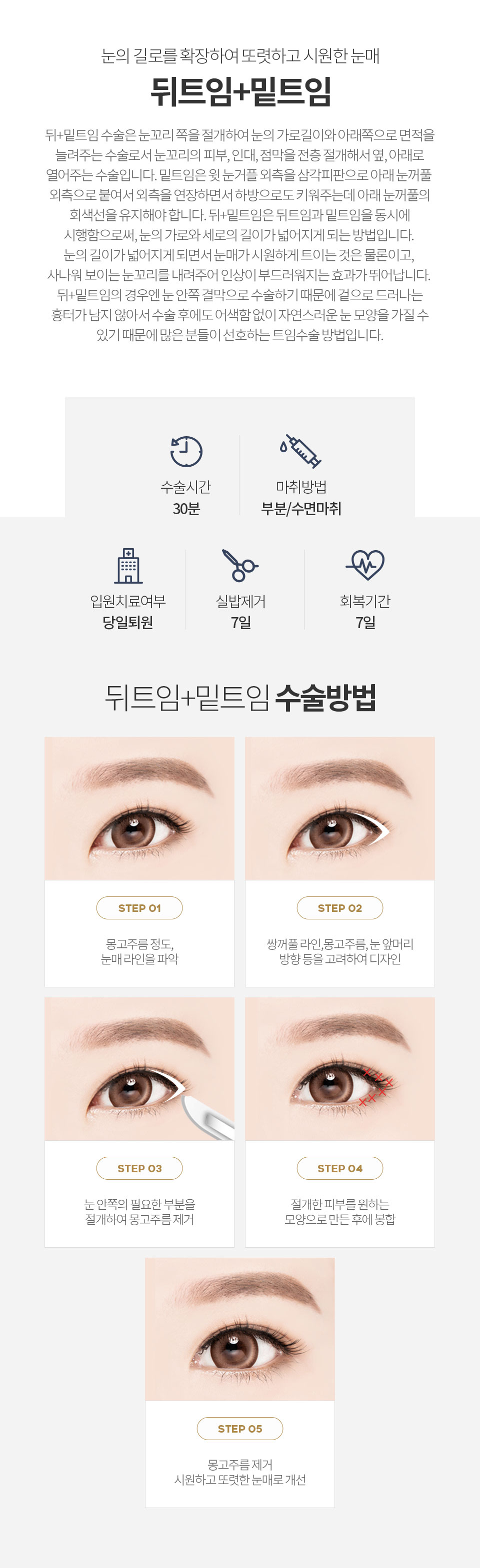 자연유착 최소절개 매몰법